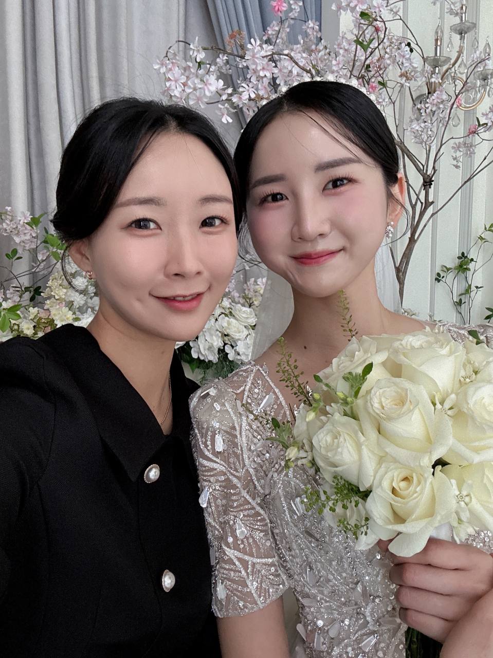 자매 시술 후기 (덴서티 600샷 + 온다 6만줄 / 코필러)