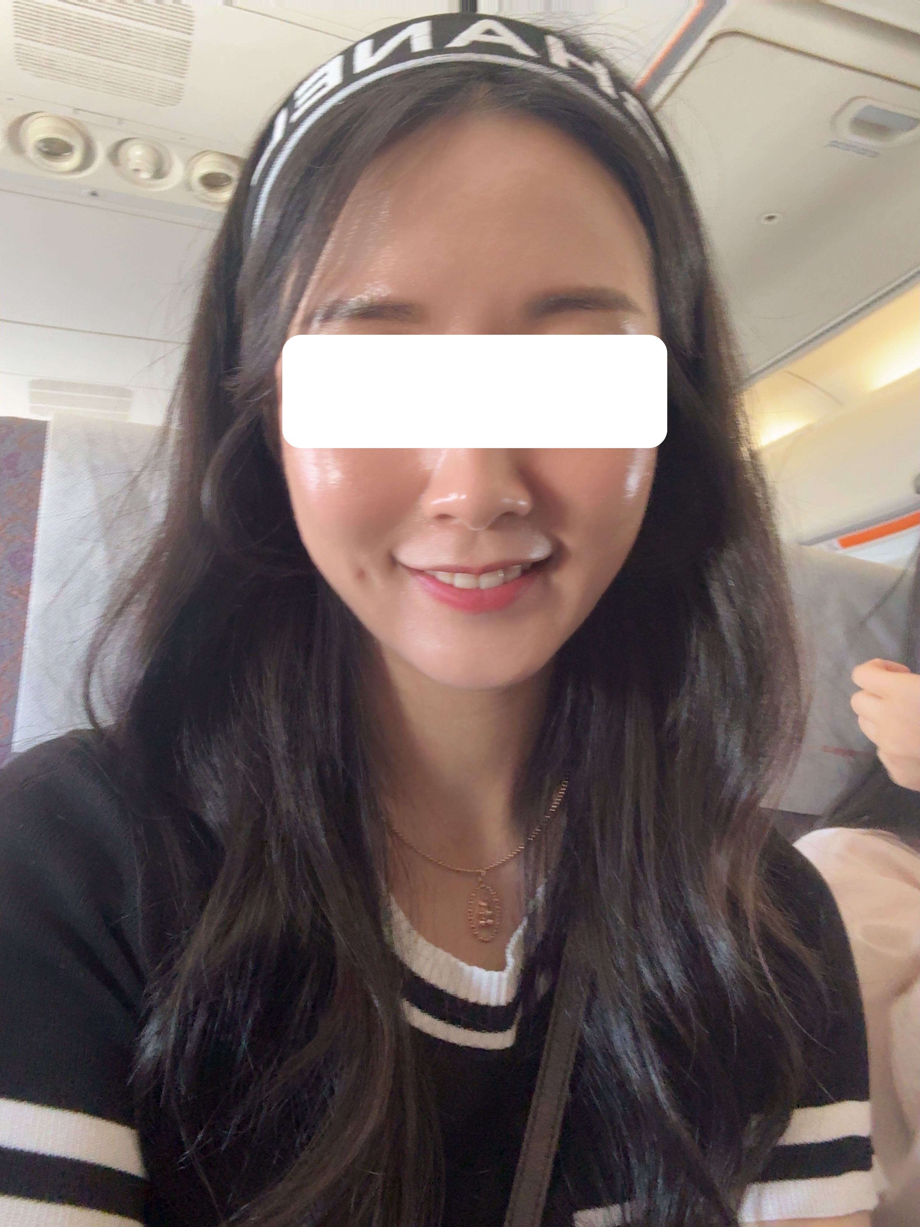 리쥬란 후기에요!