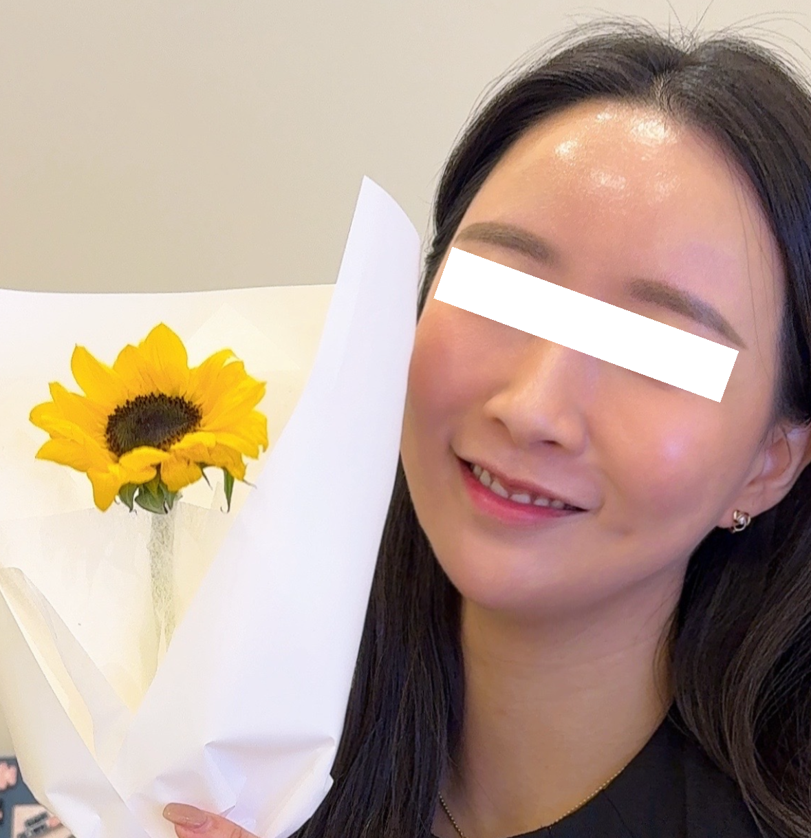 리쥬란힐러 시술후기