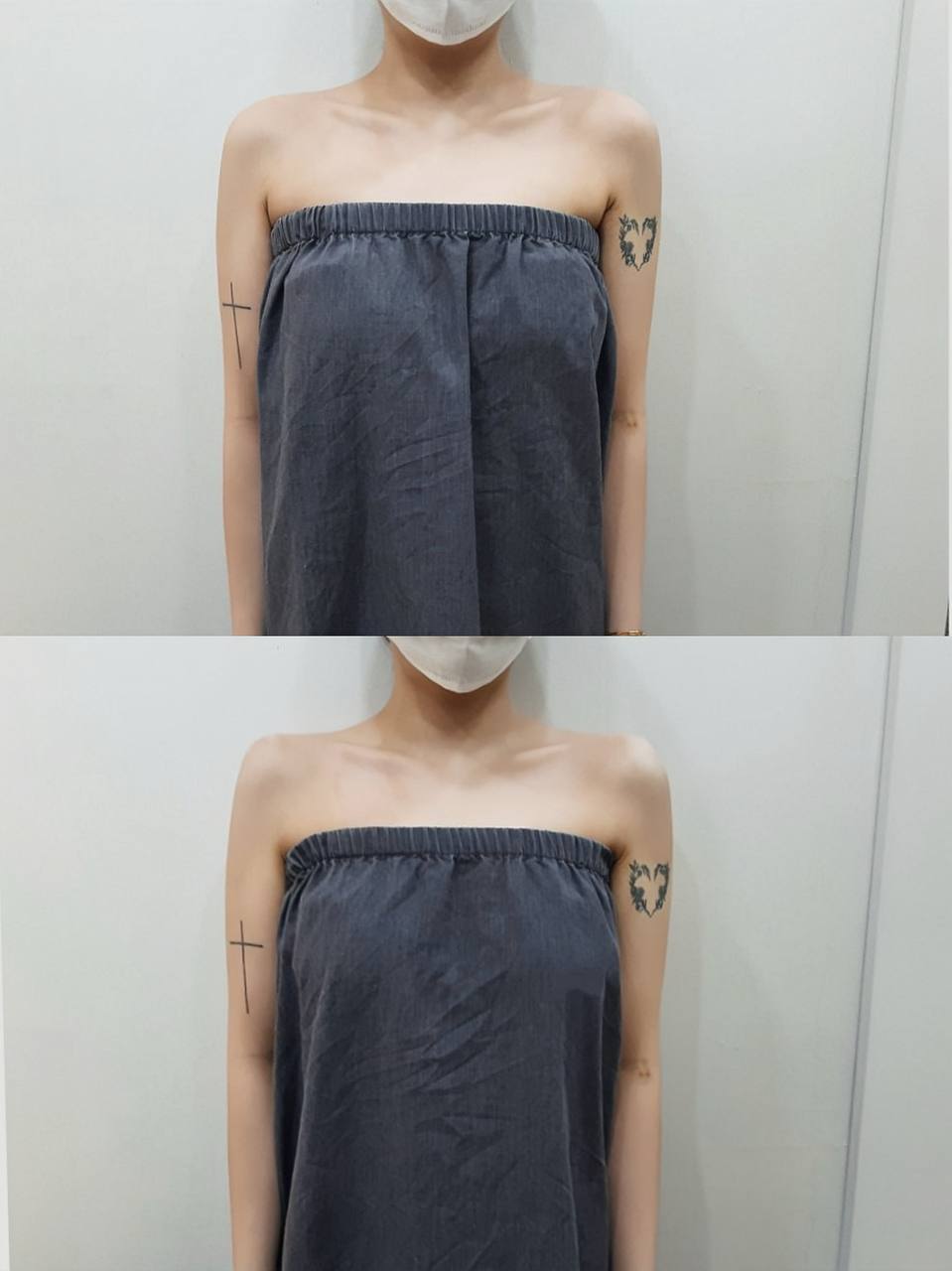 어깨필러 후기