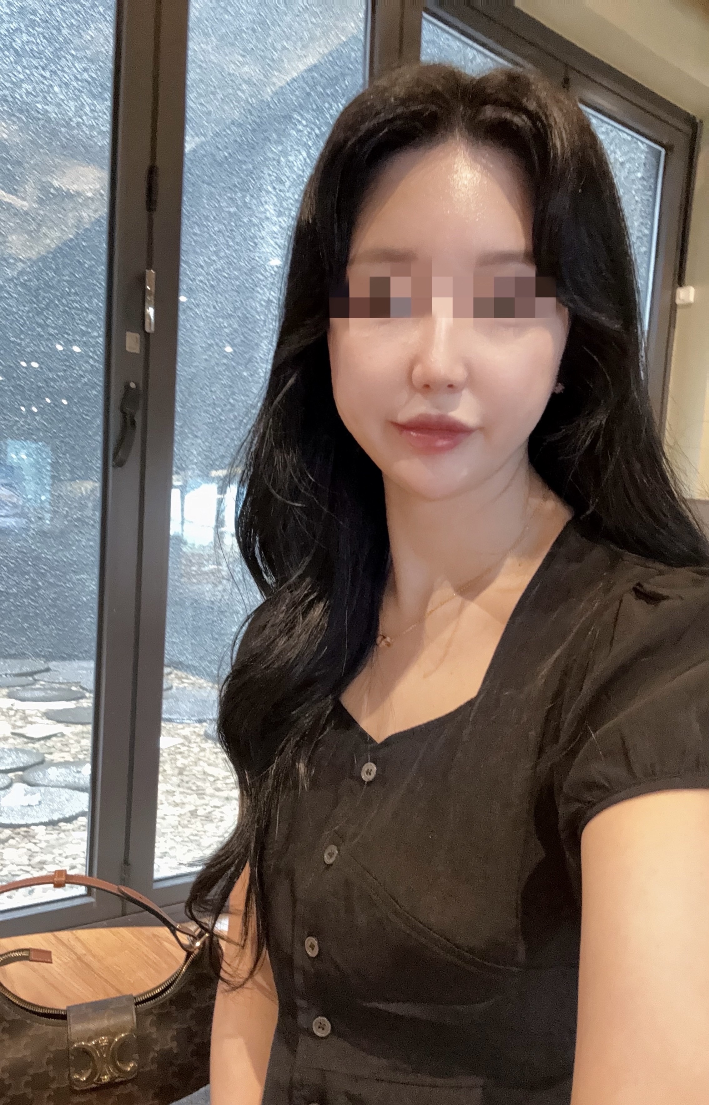 이마,입술 필러